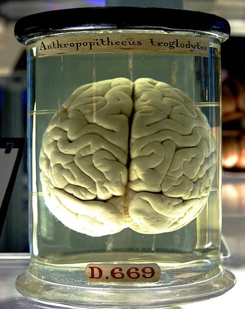 Human brain